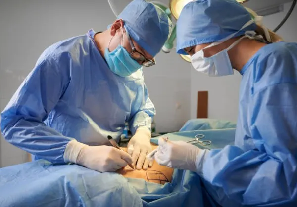 Tummy tuck surgeons; performing surgery
