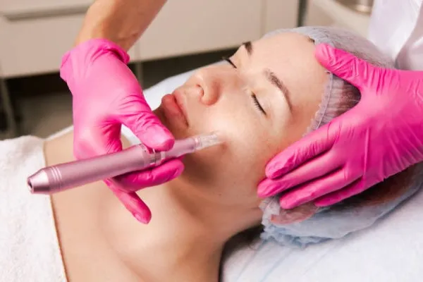 Dermapen treatment being performed on a woman by a doctor wearing pink latex gloves for hygiene
