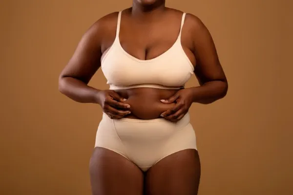 Liposuction cost, image of an African-American woman