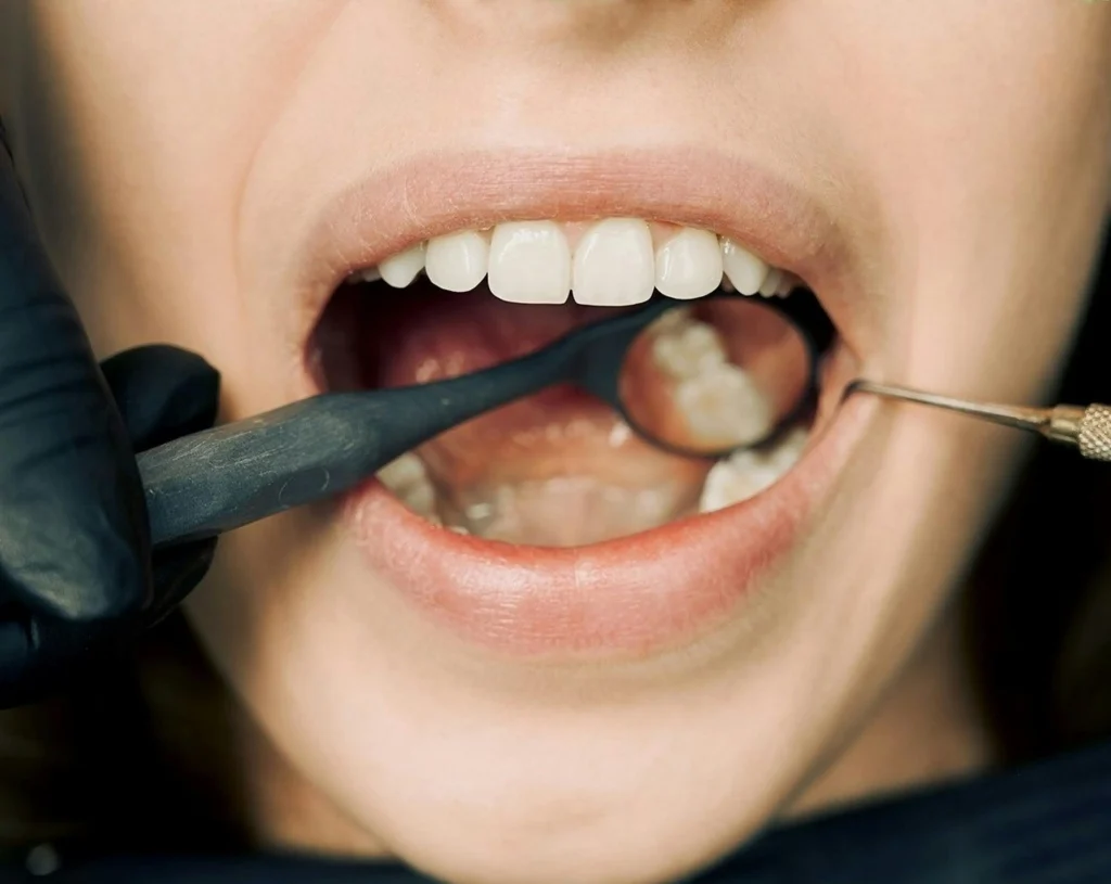 A dentist carefully examining a patient’s mouth after a dental implant procedure, explaining follow-up care and how much are dental implants.