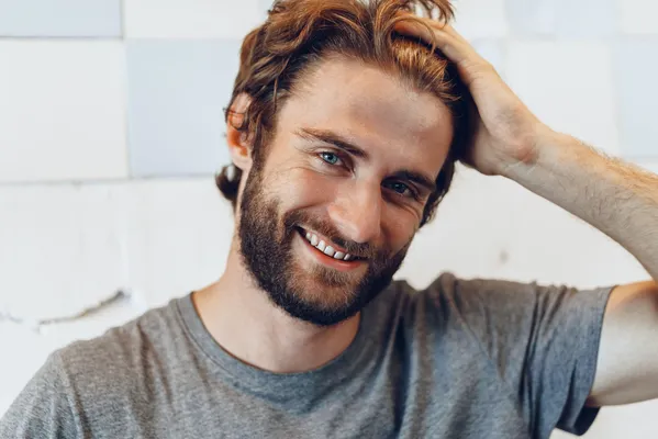 Visible hair density improvement in man's post-FUT hair transplant recovery.