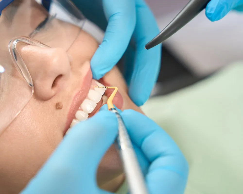 Close-up of a dentist working with a small tool on a patient’s tooth surface during a detailed procedure, representing hands-on techniques in dental works vs traditional dental treatments