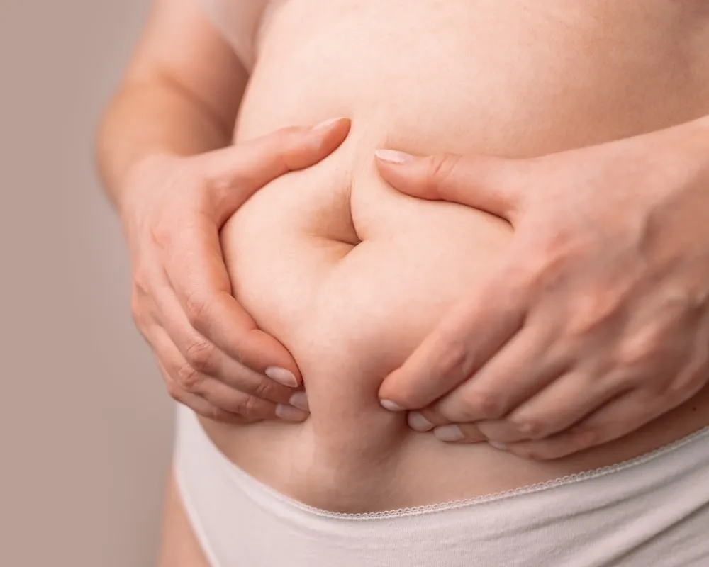 Overweight female patient grabbing abdominal fat in preparation for a plastic surgery consultation, representing common concerns addressed by different types of liposuction techniques