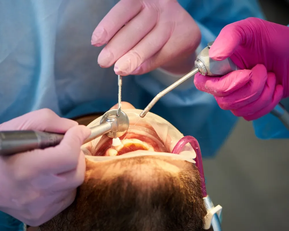 Patient receiving a professional dental cleaning as part of preventive oral care, highlighting a key practice within traditional methods in dental works vs traditional dental treatments