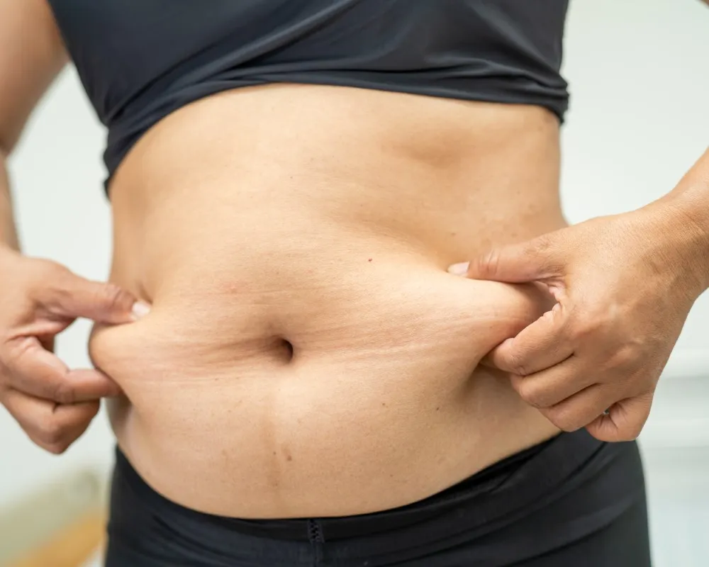 Woman holding loose skin on her lower stomach while considering body contouring surgery, symbolizing the need for different types of tummy tuck depending on skin condition and goals