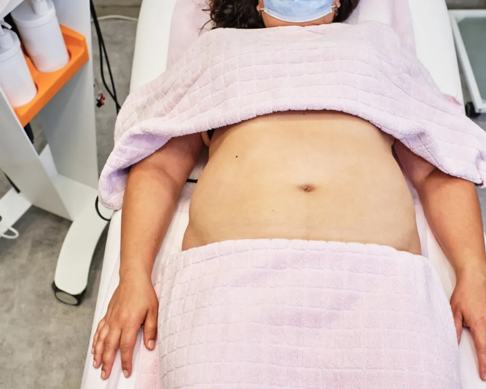 Female patient lying on the surgical table moments before beginning a fat removal procedure, ready to undergo one of several types of liposuction depending on her body needs
