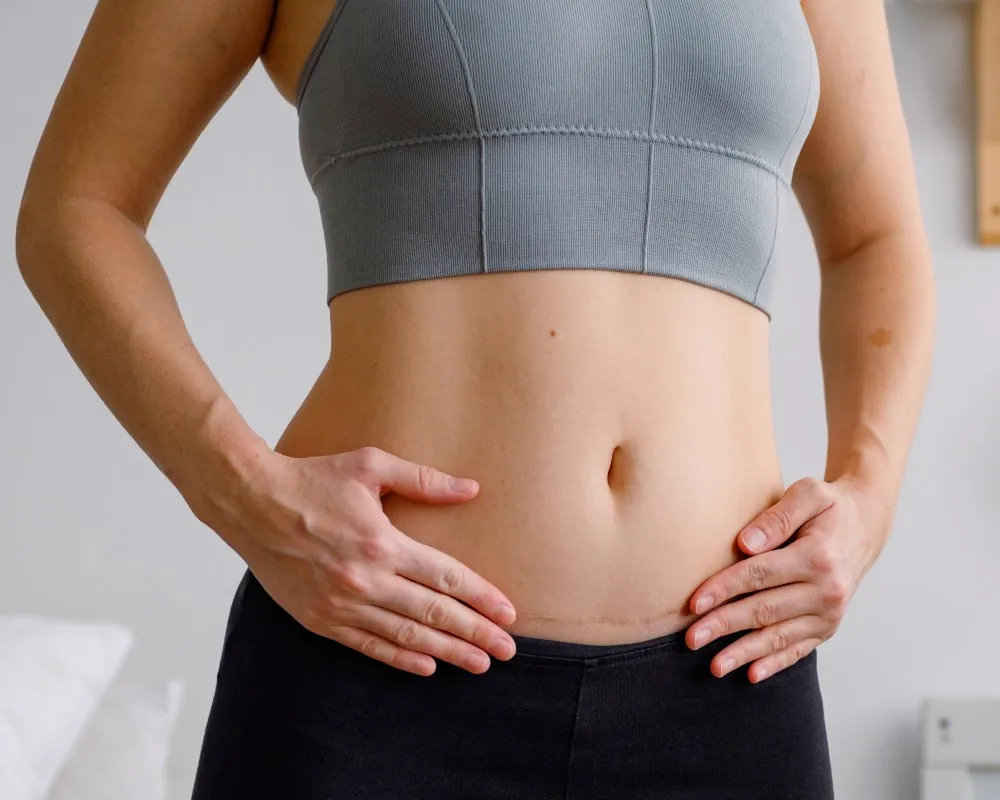 Slim young woman showing off her flat stomach after undergoing body contouring surgery, reflecting results that can be achieved through different types of liposuction procedures
