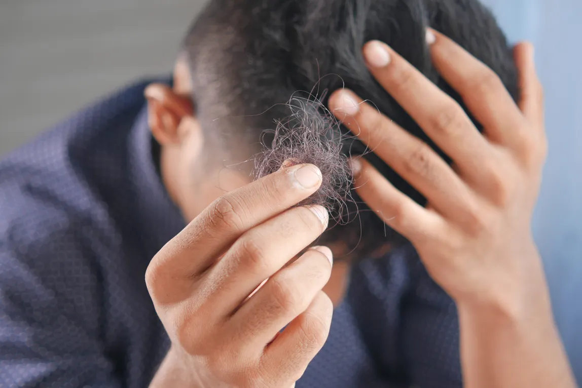 Man holding a lock of hair in his hand, showing hair loss solutions to address thinning and shedding problems