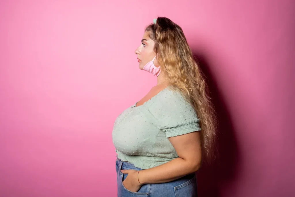 Portrait of a young woman with a noticeably large bust who is considered an ideal candidate for breast reductions to relieve back and shoulder pain.