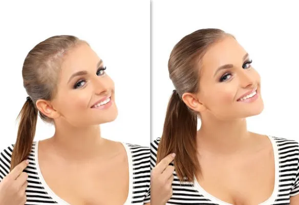 Antes y después de una mujer que se sometió a un procedimiento capilar, representando de manera general los cambios que pueden obtenerse mediante hair treatments sin entrar en detalles específicos.