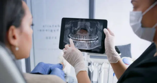 Dental extraction cost depending on extraction type