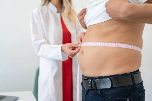 Specialist measuring a man’s abdomen during a consultation before a liposuction procedure