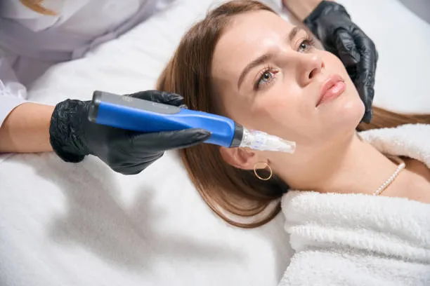What is Dermapen microneedling performed by a skincare specialist