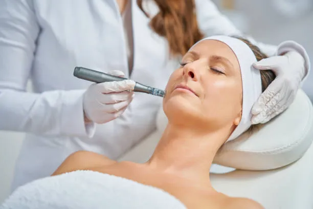 What is Dermapen microneedling and its skin rejuvenation benefits