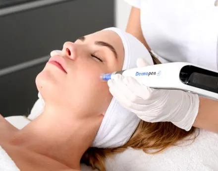 Dermapen How Microneedling Works and What Results to Expect
