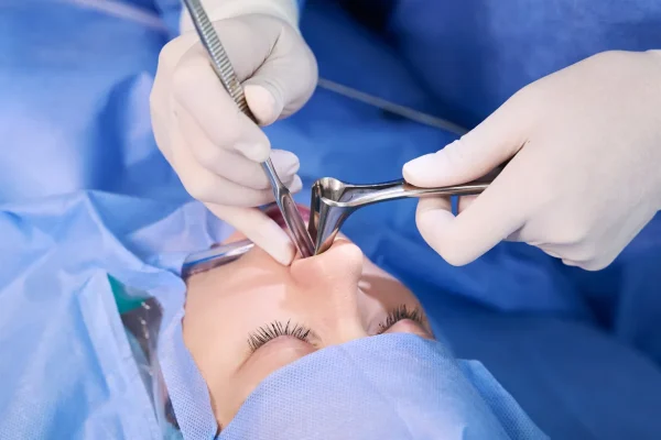 Surgical demonstration of open approach among common types of rhinoplasty