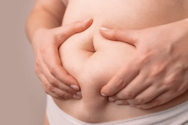 Overweight female patient grabbing abdominal fat in preparation for a plastic surgery consultation, representing common concerns addressed by different types of liposuction techniques