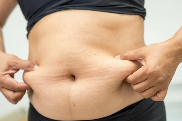 Woman holding loose skin on her lower stomach while considering body contouring surgery, symbolizing the need for different types of tummy tuck depending on skin condition and goals